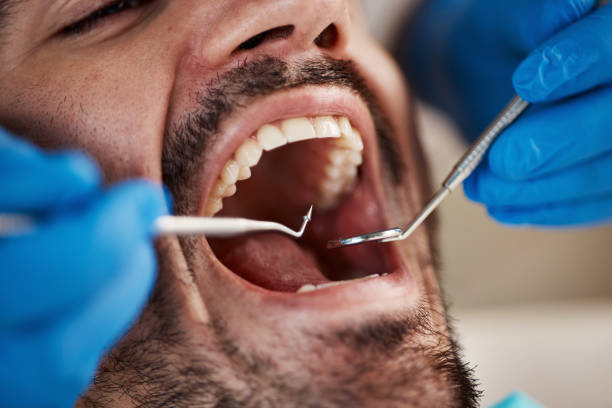 Best Emergency Dental Extractions in Andale, KS
